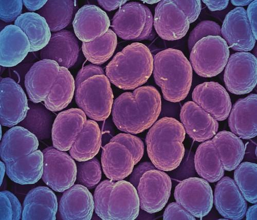 Neisseria gonorrhoeae, il batterio che causa la gonorrea a trasmissione sessuale. Fonte immagine: NIAID