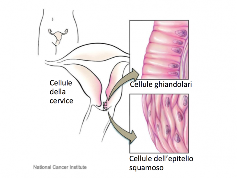 Cellule della Cervice Uterina. Fonte immagine: National Cancer Institute