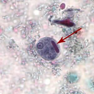 Cisti di Entamoeba histolytica viste al microscopio. Fonte immagine: CDC